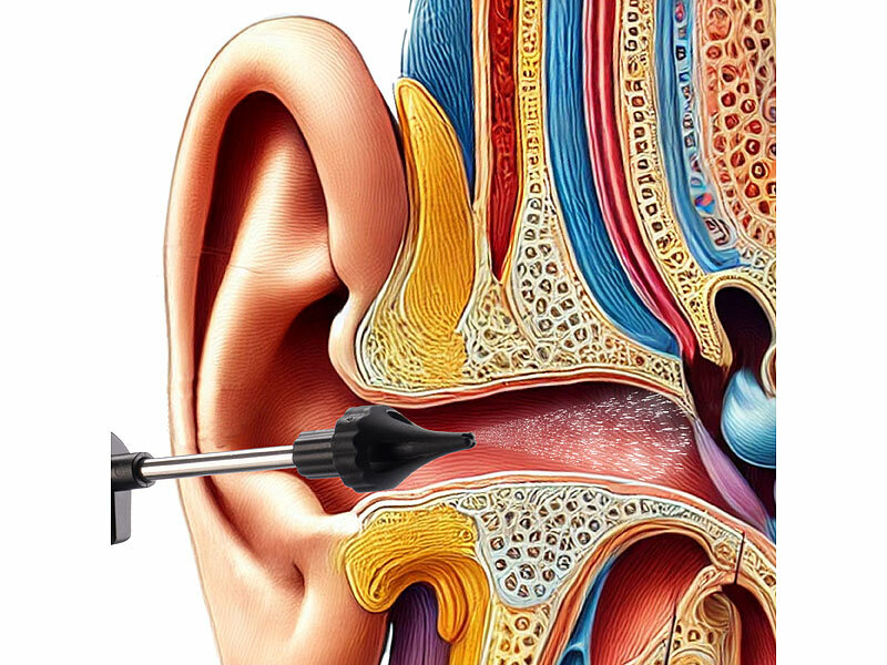 ; Ohrreiniger, OhrenreinigerAkku-OhrreinigerElektrische Akku-OhrreinigerOtoskop KamerasOhrenschmalz Entferner OtoskopeOhrenschmalz-Entferner-SetsOhrenschmalz Entferner Cleaner ears Ohren Lichter Ohrenleuchten EndoskopeOhrkamerasOhrenschmalzentfernerOtoskopeWLAN-OtoskopeKameras WLAN WiFi wireless Cameras Otologie Diagnosen OhrenspiegelOhrreinigungsgeräteWattestäbchen Ohrlöffelchen Instrumente Ohrenstäbchen OhrpflegeOhrenpflegeOhrwachsentfernerOhrspülungenReinigungen Ohrlampen Pflege Reiniger Akkus Werkzeuge EntfernenOtoscopesReinigungswerkzeuge Ohrreiniger, OhrenreinigerAkku-OhrreinigerElektrische Akku-OhrreinigerOtoskop KamerasOhrenschmalz Entferner OtoskopeOhrenschmalz-Entferner-SetsOhrenschmalz Entferner Cleaner ears Ohren Lichter Ohrenleuchten EndoskopeOhrkamerasOhrenschmalzentfernerOtoskopeWLAN-OtoskopeKameras WLAN WiFi wireless Cameras Otologie Diagnosen OhrenspiegelOhrreinigungsgeräteWattestäbchen Ohrlöffelchen Instrumente Ohrenstäbchen OhrpflegeOhrenpflegeOhrwachsentfernerOhrspülungenReinigungen Ohrlampen Pflege Reiniger Akkus Werkzeuge EntfernenOtoscopesReinigungswerkzeuge Ohrreiniger, OhrenreinigerAkku-OhrreinigerElektrische Akku-OhrreinigerOtoskop KamerasOhrenschmalz Entferner OtoskopeOhrenschmalz-Entferner-SetsOhrenschmalz Entferner Cleaner ears Ohren Lichter Ohrenleuchten EndoskopeOhrkamerasOhrenschmalzentfernerOtoskopeWLAN-OtoskopeKameras WLAN WiFi wireless Cameras Otologie Diagnosen OhrenspiegelOhrreinigungsgeräteWattestäbchen Ohrlöffelchen Instrumente Ohrenstäbchen OhrpflegeOhrenpflegeOhrwachsentfernerOhrspülungenReinigungen Ohrlampen Pflege Reiniger Akkus Werkzeuge EntfernenOtoscopesReinigungswerkzeuge Ohrreiniger, OhrenreinigerAkku-OhrreinigerElektrische Akku-OhrreinigerOtoskop KamerasOhrenschmalz Entferner OtoskopeOhrenschmalz-Entferner-SetsOhrenschmalz Entferner Cleaner ears Ohren Lichter Ohrenleuchten EndoskopeOhrkamerasOhrenschmalzentfernerOtoskopeWLAN-OtoskopeKameras WLAN WiFi wireless Cameras Otologie Diagnosen OhrenspiegelOhrreinigungsgeräteWattestäbchen Ohrlöffelchen Instrumente Ohrenstäbchen OhrpflegeOhrenpflegeOhrwachsentfernerOhrspülungenReinigungen Ohrlampen Pflege Reiniger Akkus Werkzeuge EntfernenOtoscopesReinigungswerkzeuge 