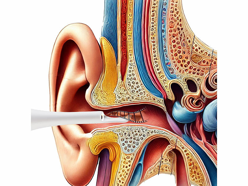 ; Ohrreiniger, OhrenreinigerAkku-OhrreinigerElektrische Akku-OhrreinigerOtoskop KamerasOhrenschmalz Entferner OtoskopeOhrenschmalz-Entferner-SetsOhrenschmalz Entferner Cleaner ears Ohren Lichter Ohrenleuchten EndoskopeOhrkamerasOhrenschmalzentfernerOtoskopeWLAN-OtoskopeKameras WLAN WiFi wireless Cameras Otologie Diagnosen OhrenspiegelOhrreinigungsgeräteWattestäbchen Ohrlöffelchen Instrumente Ohrenstäbchen OhrpflegeOhrenpflegeOhrwachsentfernerOhrspülungenReinigungen Ohrlampen Pflege Reiniger Akkus Werkzeuge EntfernenOtoscopesReinigungswerkzeuge Ohrreiniger, OhrenreinigerAkku-OhrreinigerElektrische Akku-OhrreinigerOtoskop KamerasOhrenschmalz Entferner OtoskopeOhrenschmalz-Entferner-SetsOhrenschmalz Entferner Cleaner ears Ohren Lichter Ohrenleuchten EndoskopeOhrkamerasOhrenschmalzentfernerOtoskopeWLAN-OtoskopeKameras WLAN WiFi wireless Cameras Otologie Diagnosen OhrenspiegelOhrreinigungsgeräteWattestäbchen Ohrlöffelchen Instrumente Ohrenstäbchen OhrpflegeOhrenpflegeOhrwachsentfernerOhrspülungenReinigungen Ohrlampen Pflege Reiniger Akkus Werkzeuge EntfernenOtoscopesReinigungswerkzeuge Ohrreiniger, OhrenreinigerAkku-OhrreinigerElektrische Akku-OhrreinigerOtoskop KamerasOhrenschmalz Entferner OtoskopeOhrenschmalz-Entferner-SetsOhrenschmalz Entferner Cleaner ears Ohren Lichter Ohrenleuchten EndoskopeOhrkamerasOhrenschmalzentfernerOtoskopeWLAN-OtoskopeKameras WLAN WiFi wireless Cameras Otologie Diagnosen OhrenspiegelOhrreinigungsgeräteWattestäbchen Ohrlöffelchen Instrumente Ohrenstäbchen OhrpflegeOhrenpflegeOhrwachsentfernerOhrspülungenReinigungen Ohrlampen Pflege Reiniger Akkus Werkzeuge EntfernenOtoscopesReinigungswerkzeuge Ohrreiniger, OhrenreinigerAkku-OhrreinigerElektrische Akku-OhrreinigerOtoskop KamerasOhrenschmalz Entferner OtoskopeOhrenschmalz-Entferner-SetsOhrenschmalz Entferner Cleaner ears Ohren Lichter Ohrenleuchten EndoskopeOhrkamerasOhrenschmalzentfernerOtoskopeWLAN-OtoskopeKameras WLAN WiFi wireless Cameras Otologie Diagnosen OhrenspiegelOhrreinigungsgeräteWattestäbchen Ohrlöffelchen Instrumente Ohrenstäbchen OhrpflegeOhrenpflegeOhrwachsentfernerOhrspülungenReinigungen Ohrlampen Pflege Reiniger Akkus Werkzeuge EntfernenOtoscopesReinigungswerkzeuge 